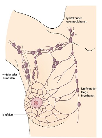 lymfesystem og kompression